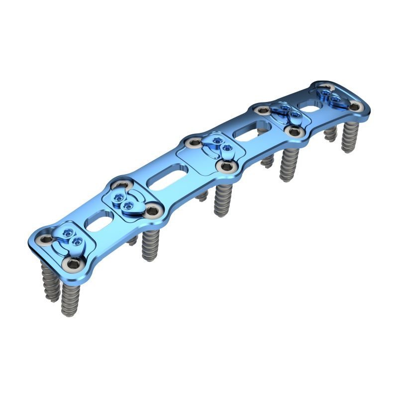 CERVELOCK<sup>TM</sup> Anterior Cervical Plate Four-Level - Titanium