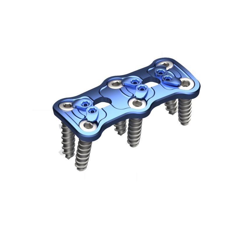 CERVELOCK<sup>TM</sup> Anterior Cervical Plate Two-Level - Titanium